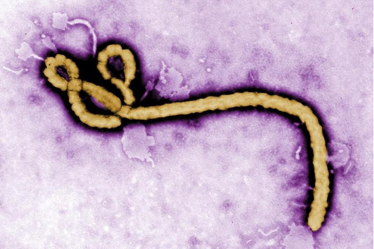 Report: Russian lawmaker claims US researched Ebola and smallpox viruses in Ukraine