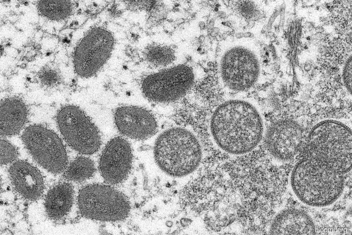 Possible monkeypox infection identified in NYC, officials say