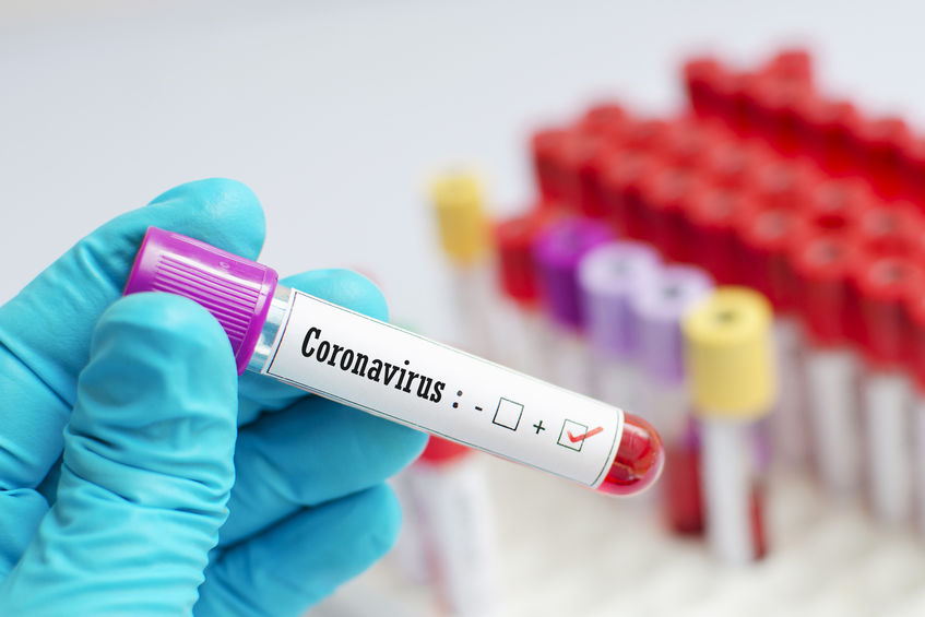 Malaysia to boost virus testing with S Korean test kits